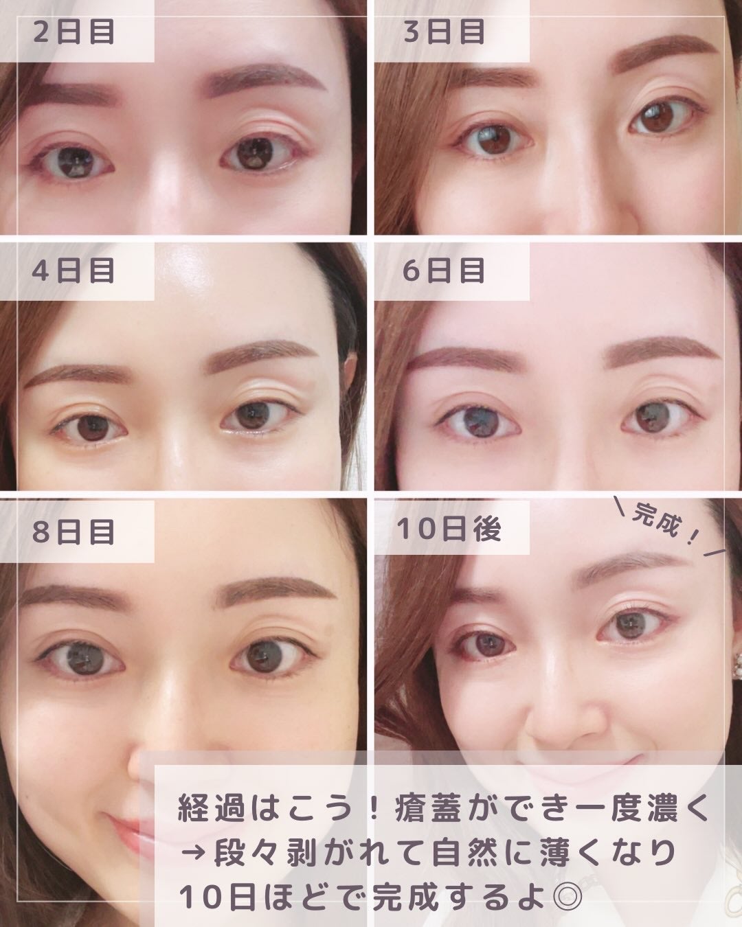 コリアーナ まみニョン (마미녕) on LIPS 「\渡韓の度通うリアル愛用サロン💋/【韓国アートメイク行くならこ..」(7枚目)