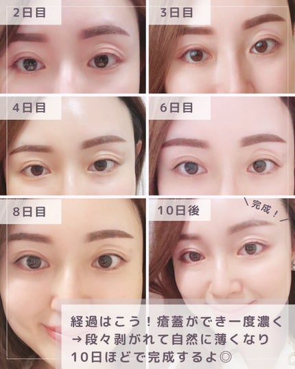 コリアーナ まみニョン (마미녕) on LIPS 「\渡韓の度通うリアル愛用サロン💋/【韓国アートメイク行くならこ..」(7枚目)