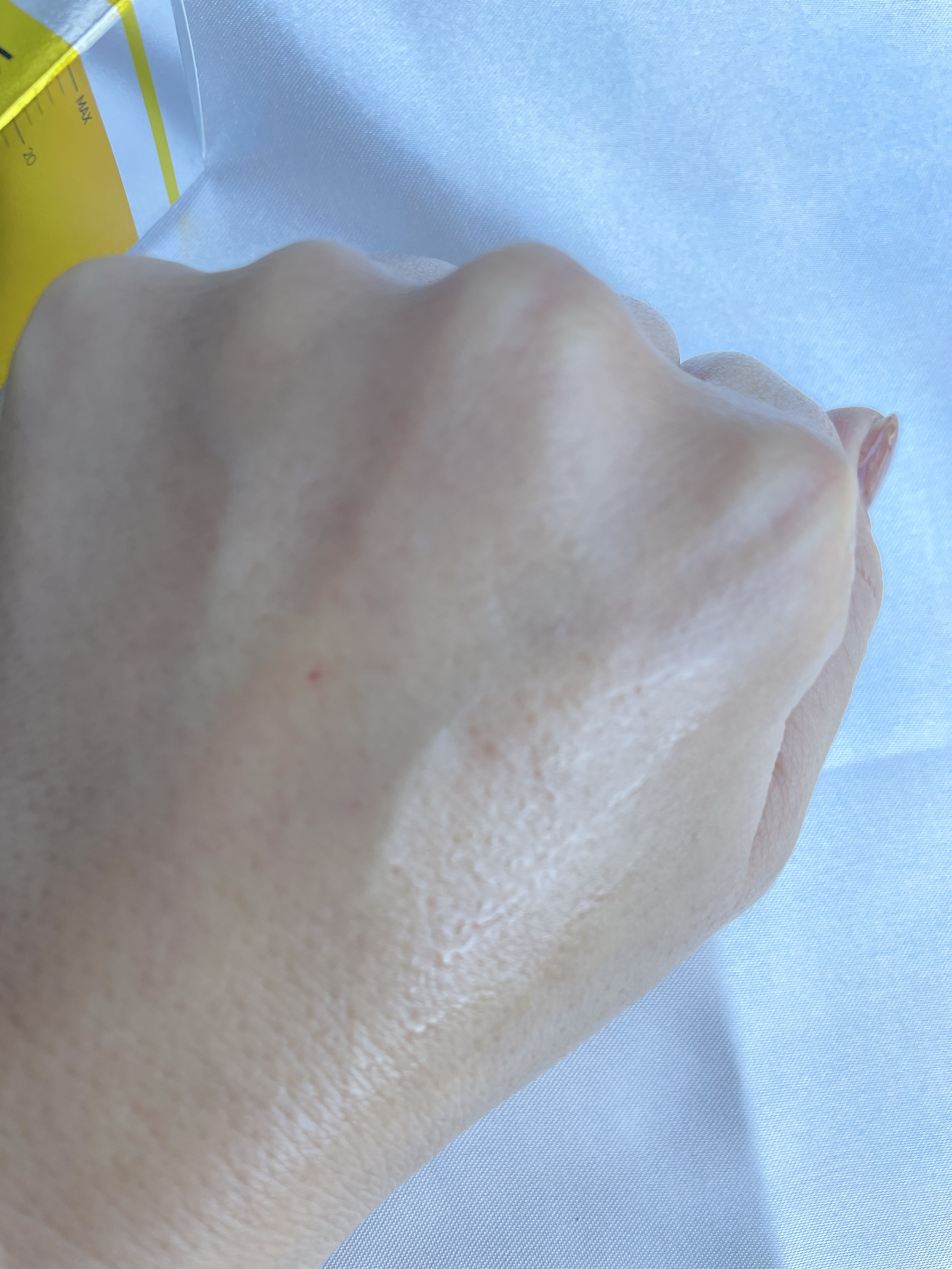 VITATECT PureVC Max Serum/LIALUSTER/美容液を使ったクチコミ（3枚目）