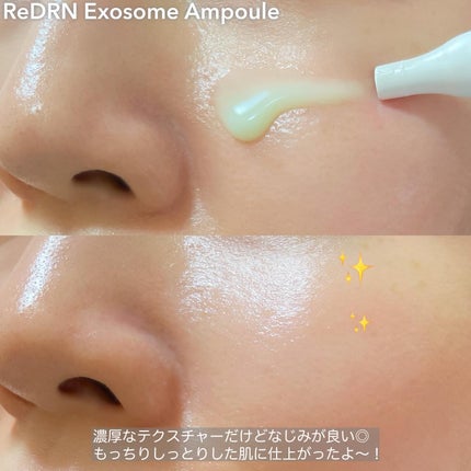 ReDRNエクソソームアンプル/Dr.nineteen/美容液を使ったクチコミ(5枚目)