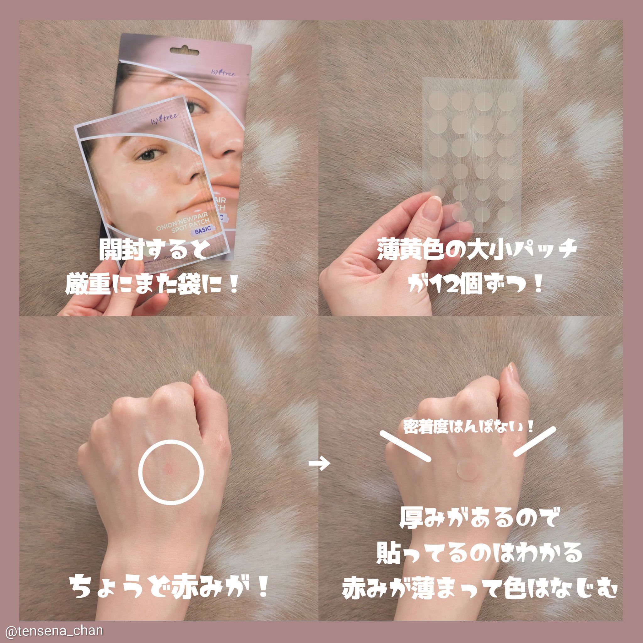 オニオン ニューペア スポットパッチ ベーシック/Isntree/にきびパッチを使ったクチコミ（2枚目）