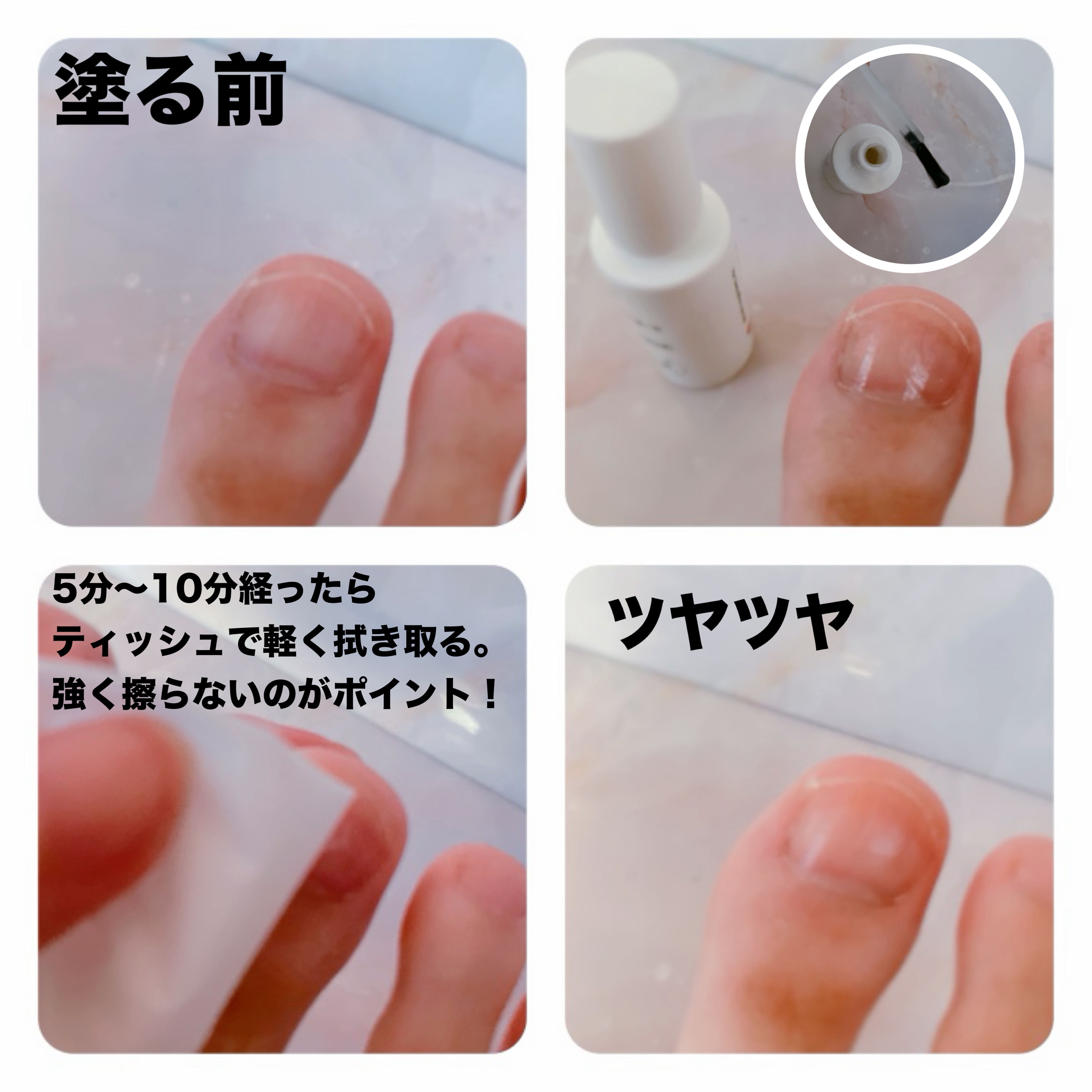 ベビーフット 足爪プロティンパック/ベビーフット/レッグ・フットケアを使ったクチコミ（2枚目）