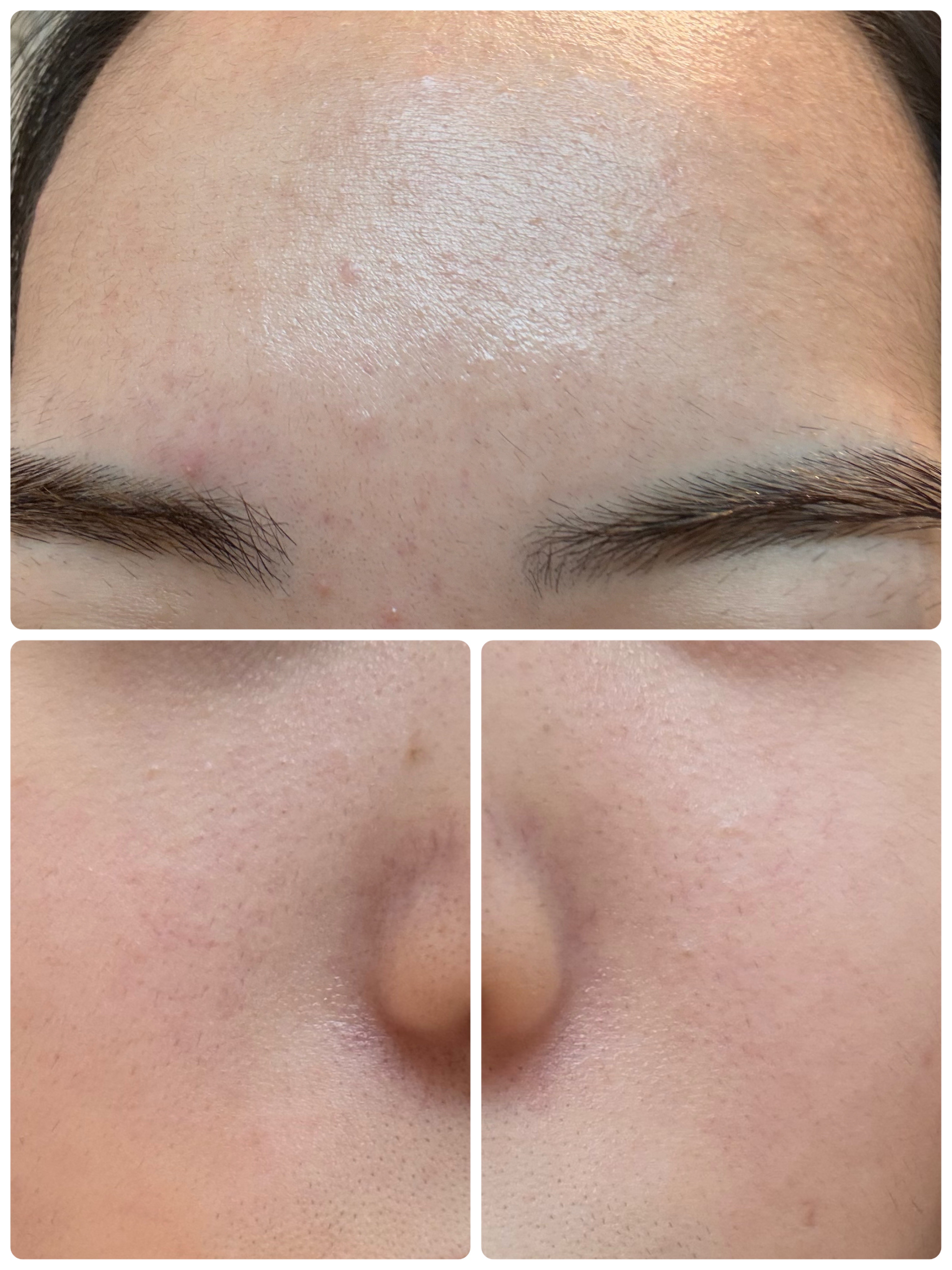 モーニングジェルウォッシュ/ビトレスキン/その他洗顔料を使ったクチコミ（3枚目）