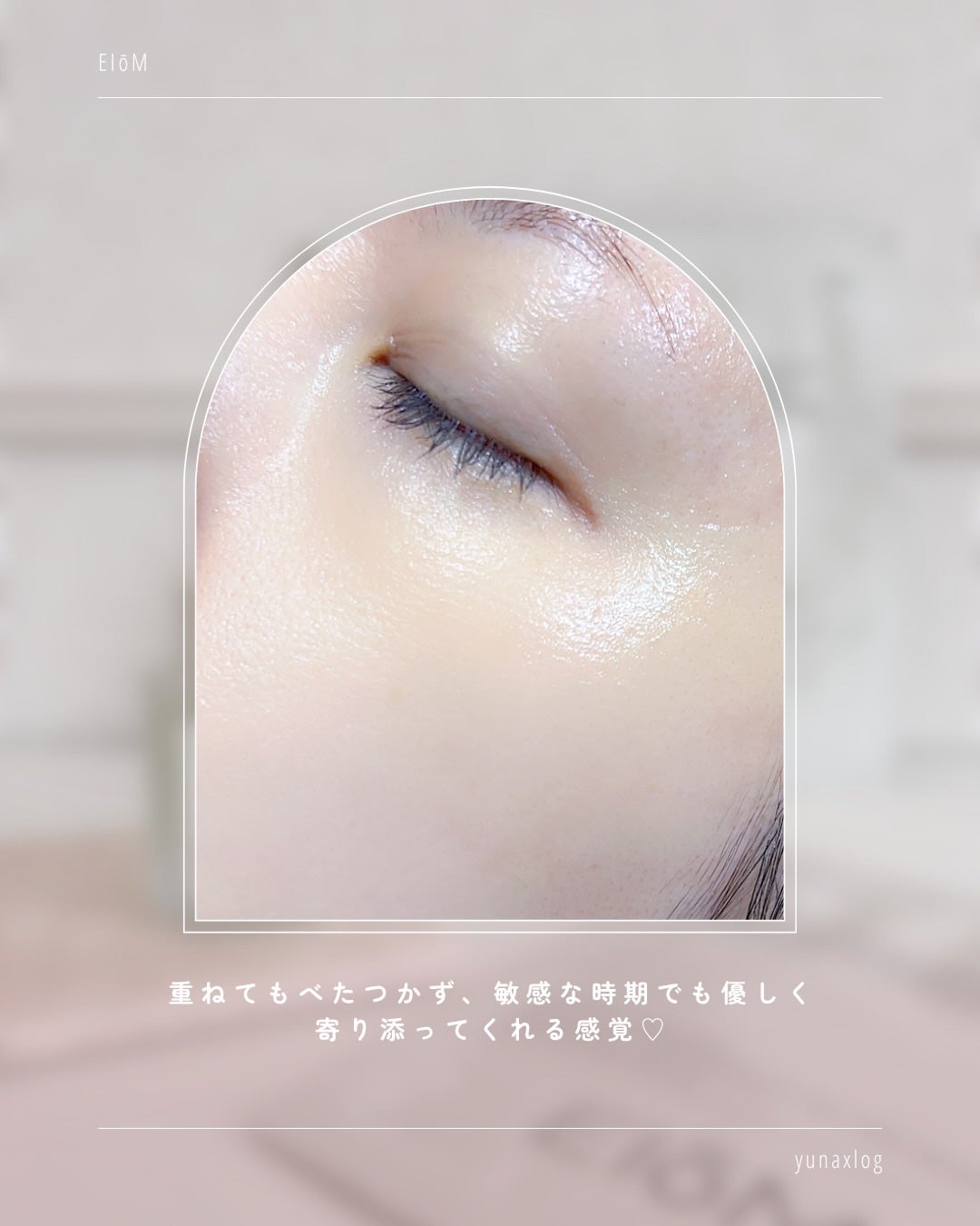 トラブルパッチマスク/EIOM/その他スキンケアを使ったクチコミ(8枚目)