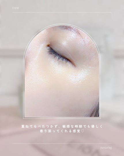 トラブルパッチマスク/EIOM/その他スキンケアを使ったクチコミ(8枚目)