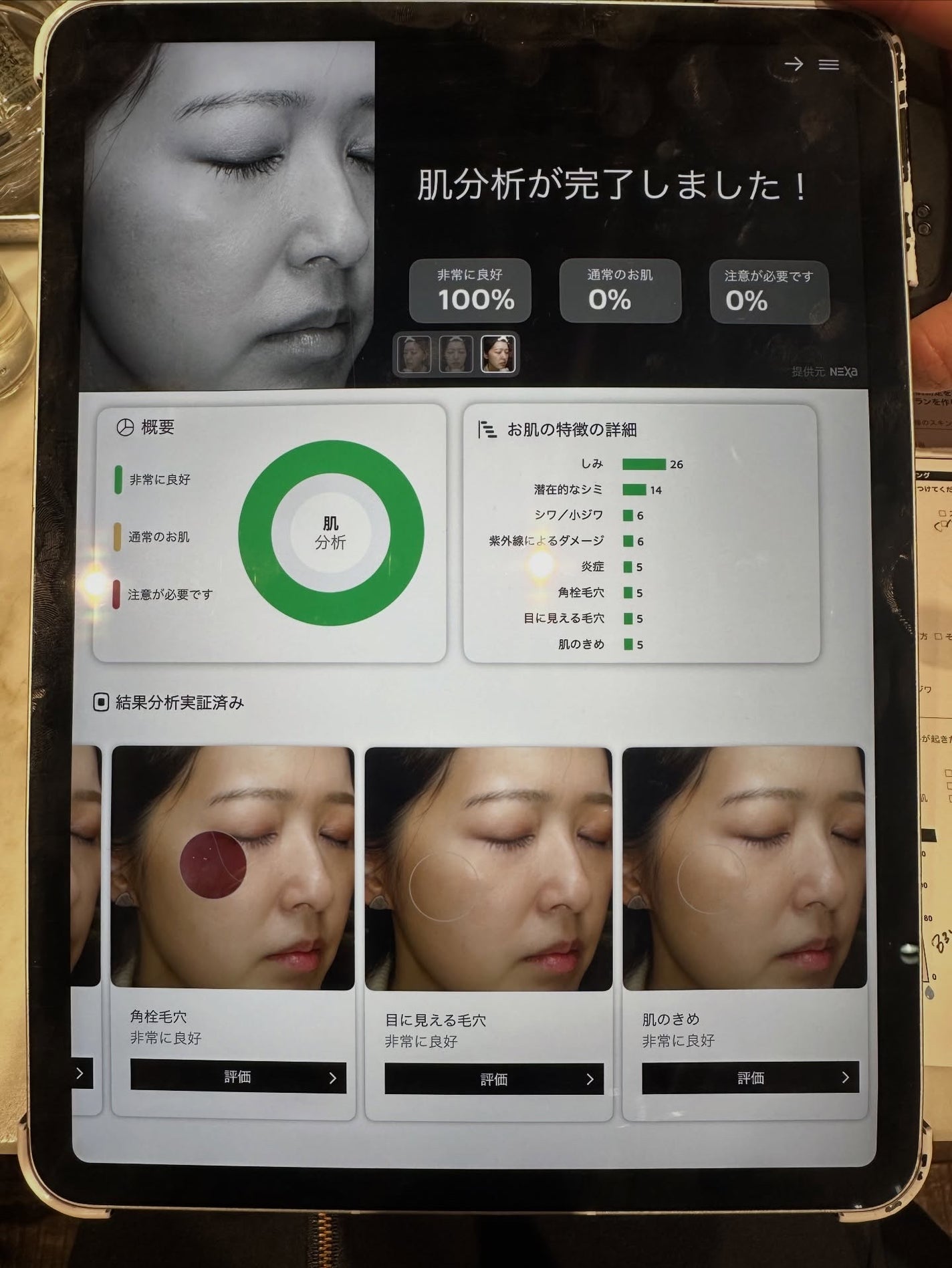 キールズ DS ライン ミルクピール トナー/Kiehl's/化粧水を使ったクチコミ(4枚目)