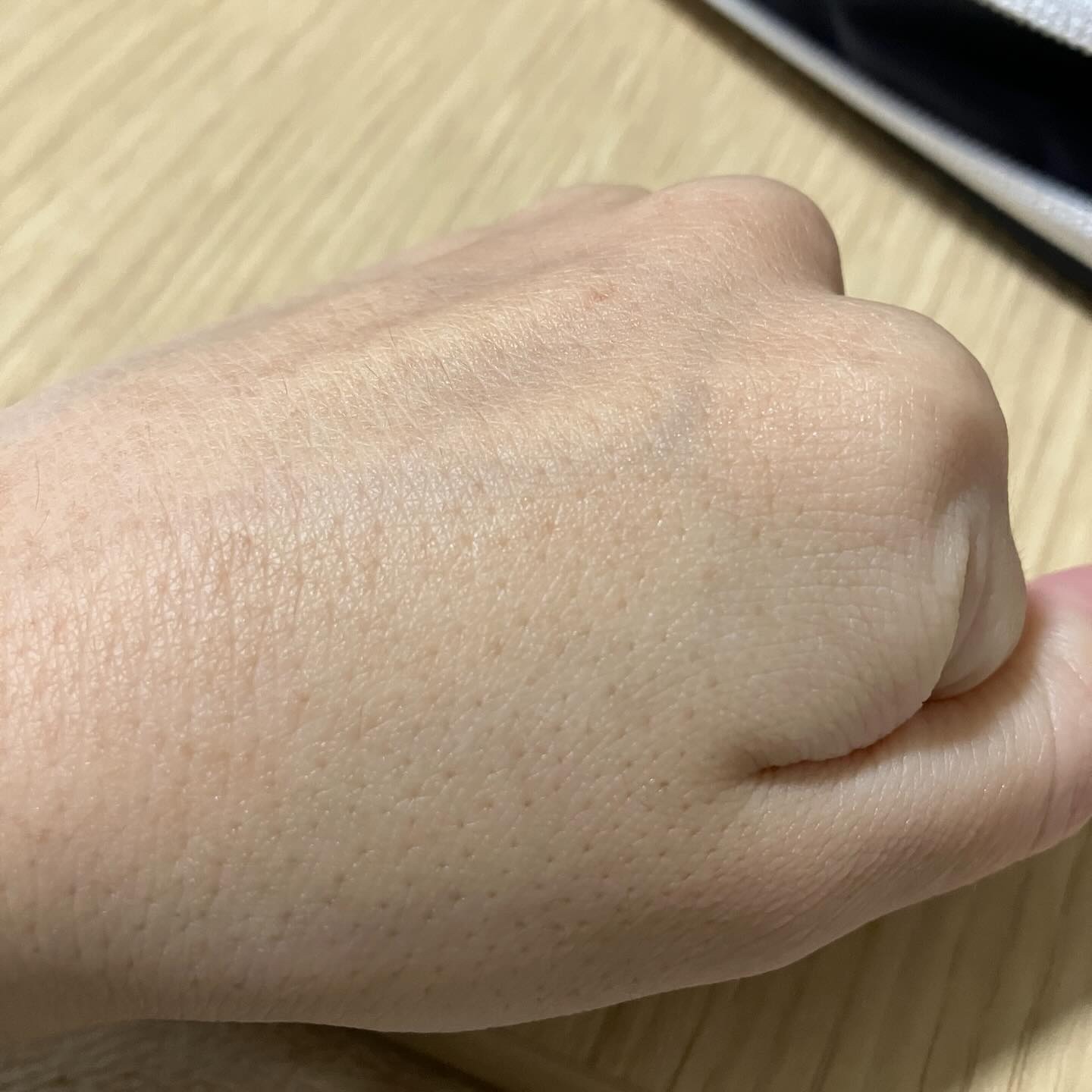 ヒアルロンシカ7秒セラム/O'earth/美容液を使ったクチコミ（3枚目）