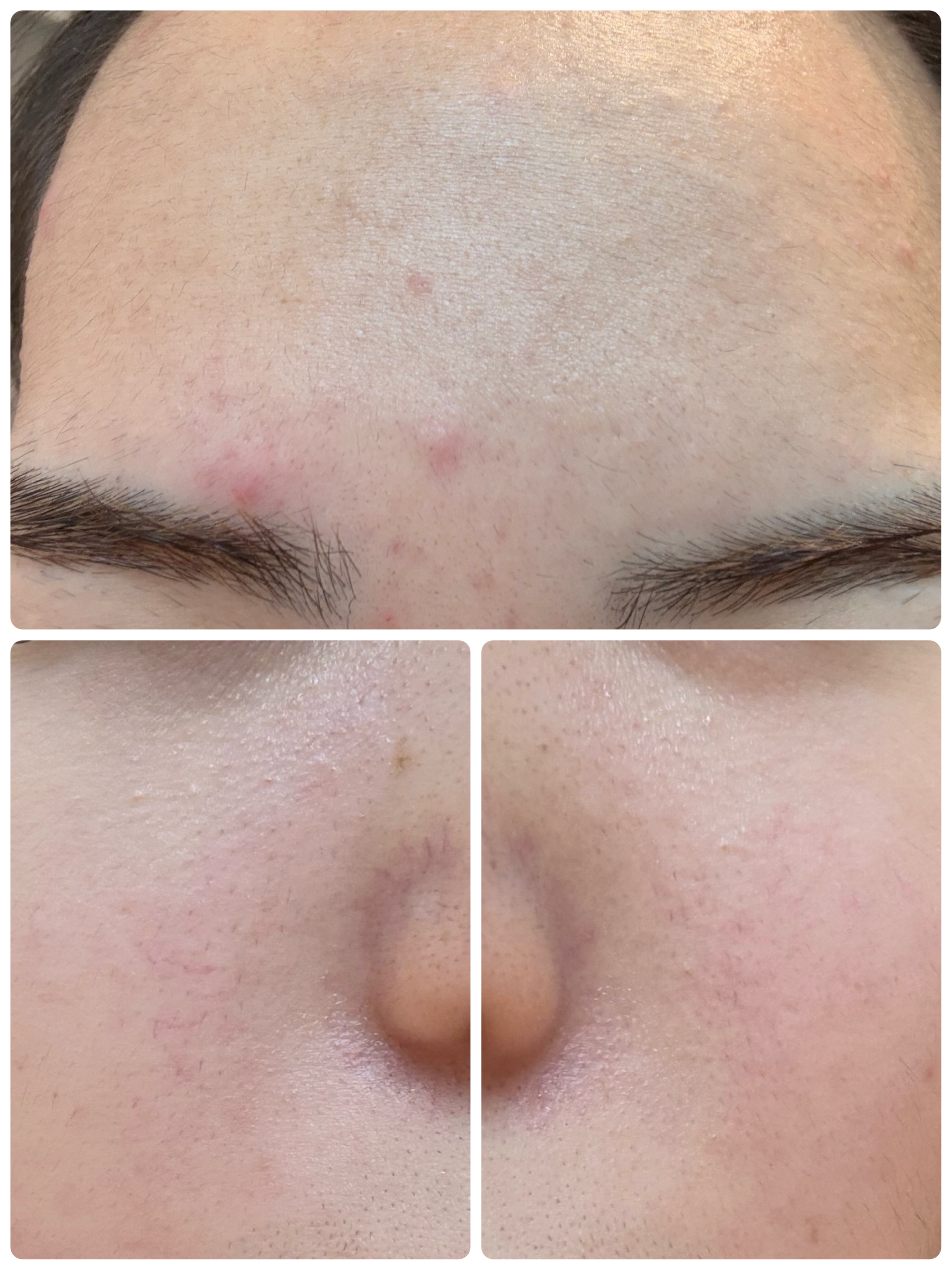 モーニングジェルウォッシュ/ビトレスキン/その他洗顔料を使ったクチコミ（3枚目）