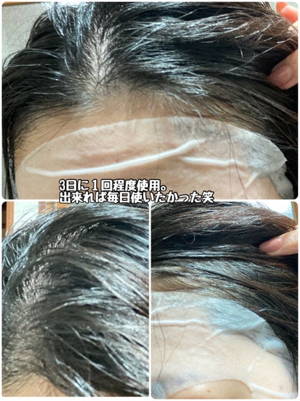 グローターンヘアアンプル/リリーイブ/頭皮ローションを使ったクチコミ(4枚目)