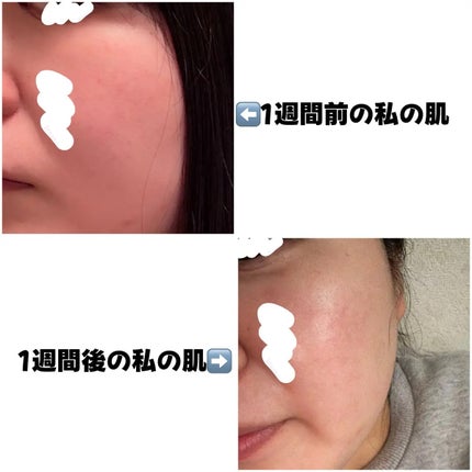 マルダ 3ステップソリューション 毛穴パック ハイドロゲルマスクパック/maldda/シートマスク・パックを使ったクチコミ(3枚目)