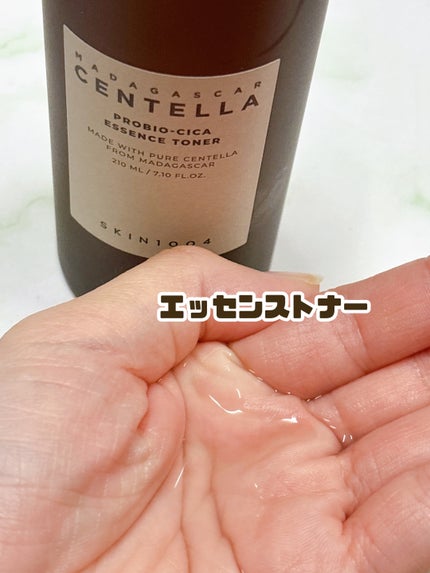 ãããã€ãªã·ã« ã€ã³ãã³ã·ã ã¢ã³ãã«/SKIN1004/çŸå®¹æ¶²ã䜿ã£ãã¯ãã³ãïŒ2æç®ïŒ