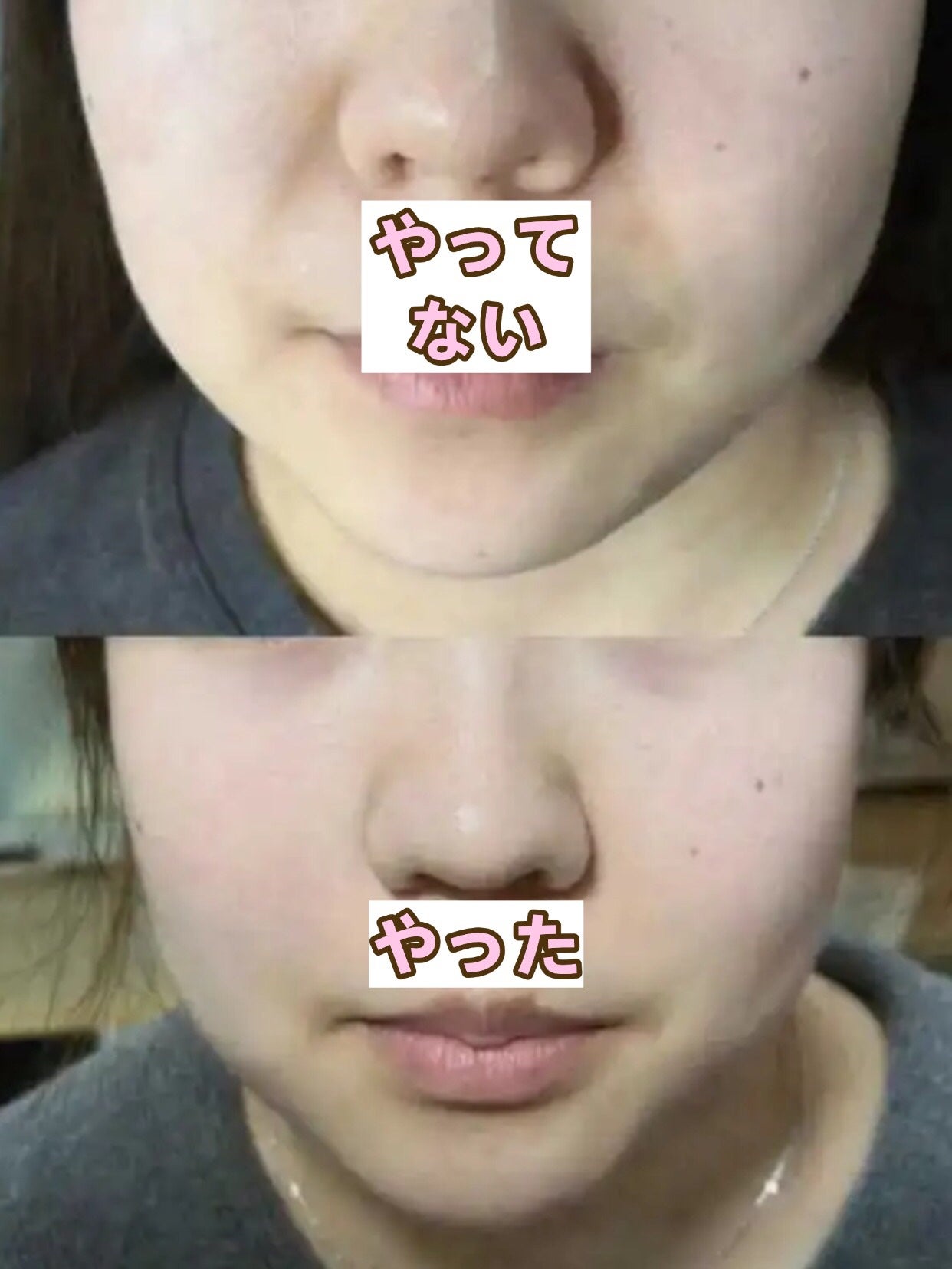 アネトス バランシング トリートメントクリーム/Anetos/フェイスクリームを使ったクチコミ(1枚目)