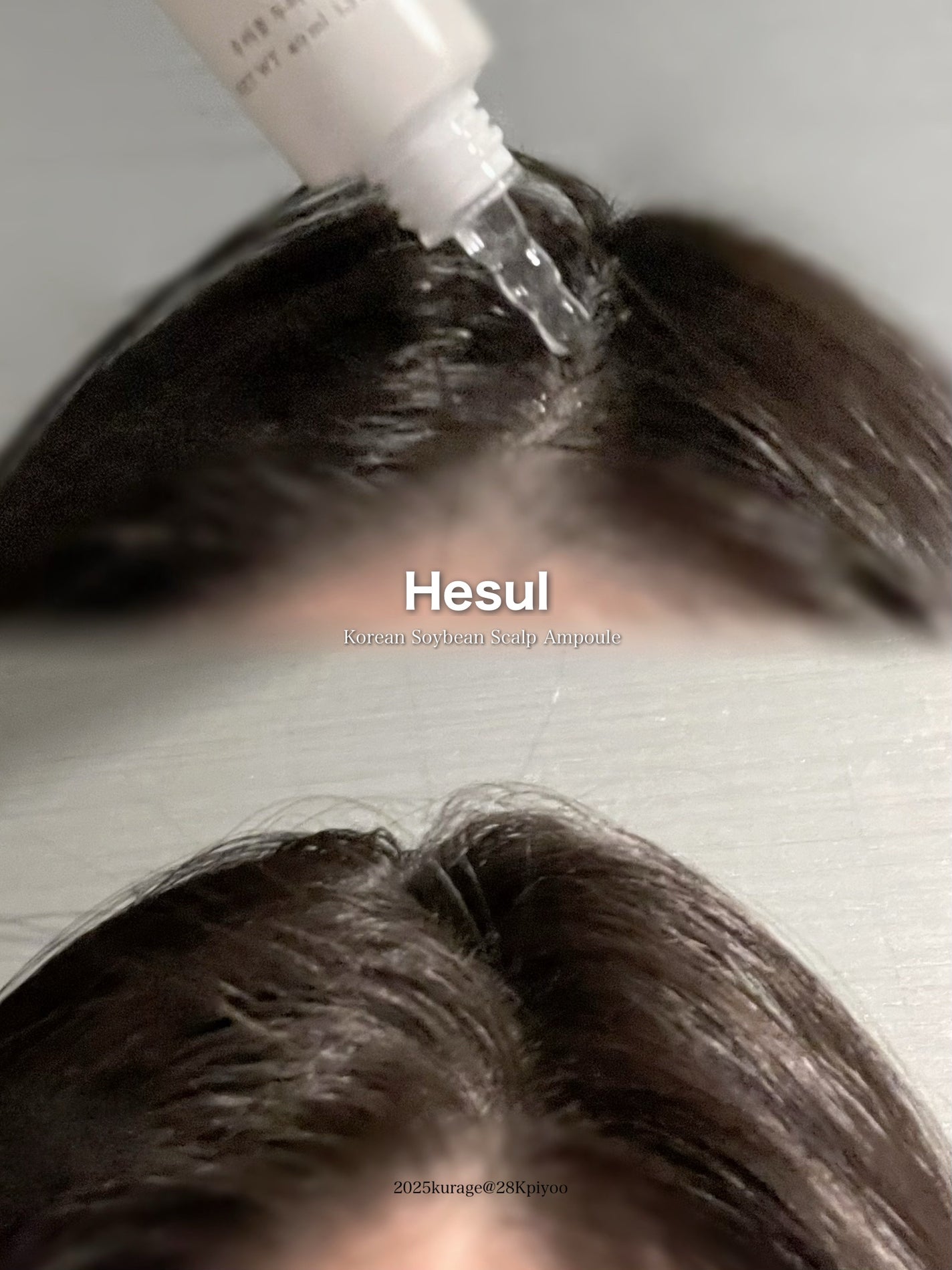 うちのソイ頭皮ケアローション/Hesul/頭皮ローションを使ったクチコミ(2枚目)