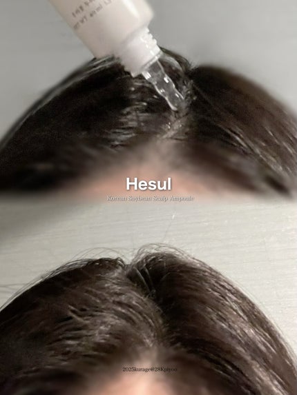 うちのソイ頭皮ケアローション/Hesul/頭皮ローションを使ったクチコミ(2枚目)
