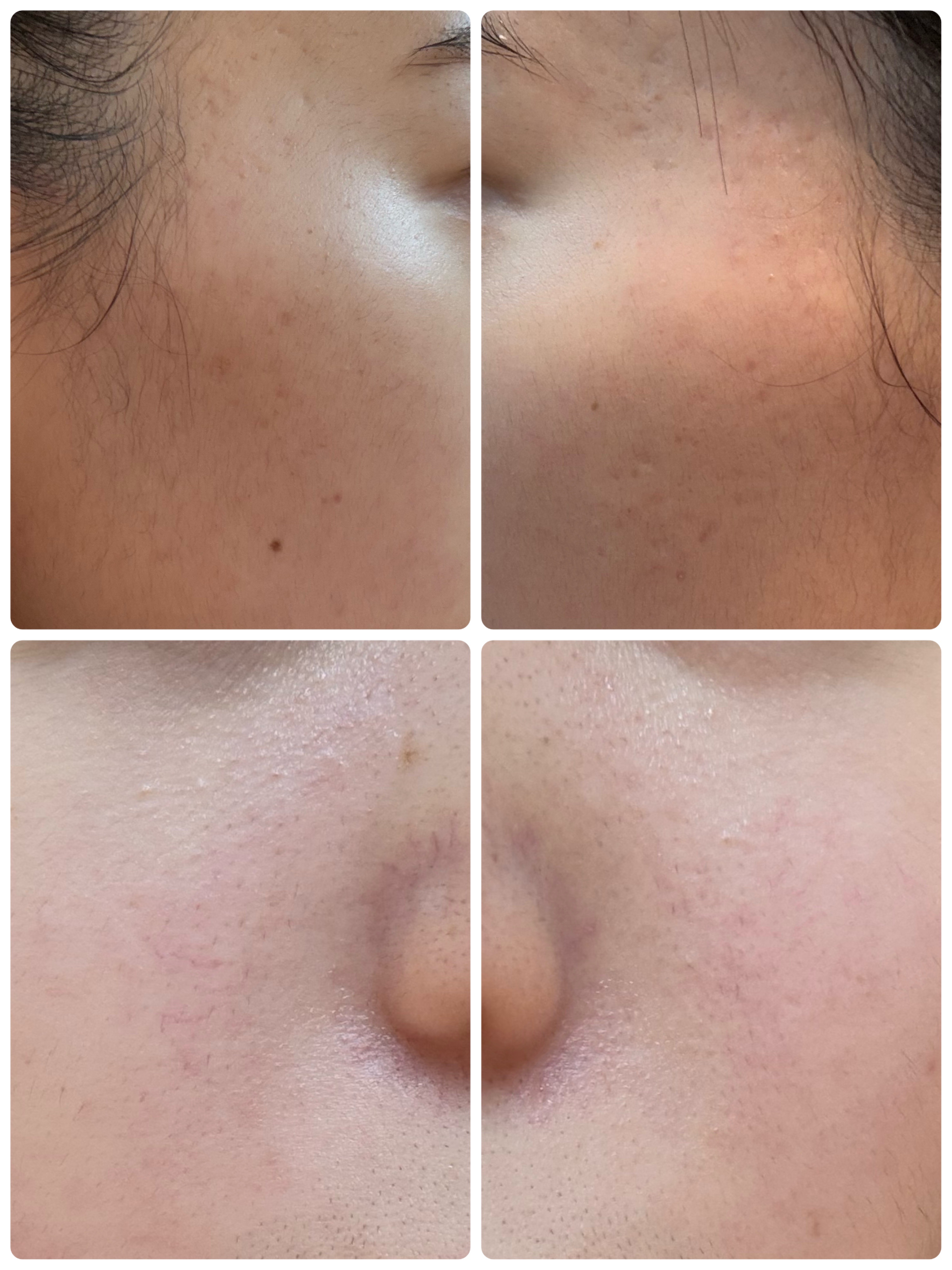 モーニングジェルウォッシュ/ビトレスキン/その他洗顔料を使ったクチコミ（2枚目）