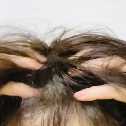 アデノバイタル スカルプ パワーショット/サブリミック/頭皮ローションを使ったクチコミ(3枚目)