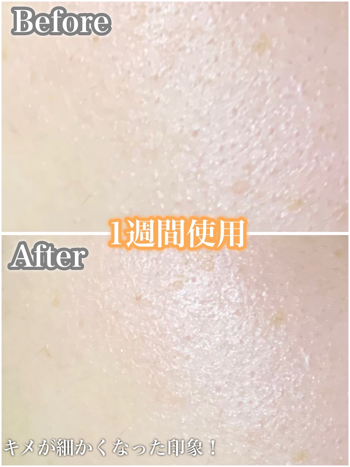 リードルショット100/VT/美容液を使ったクチコミ(4枚目)