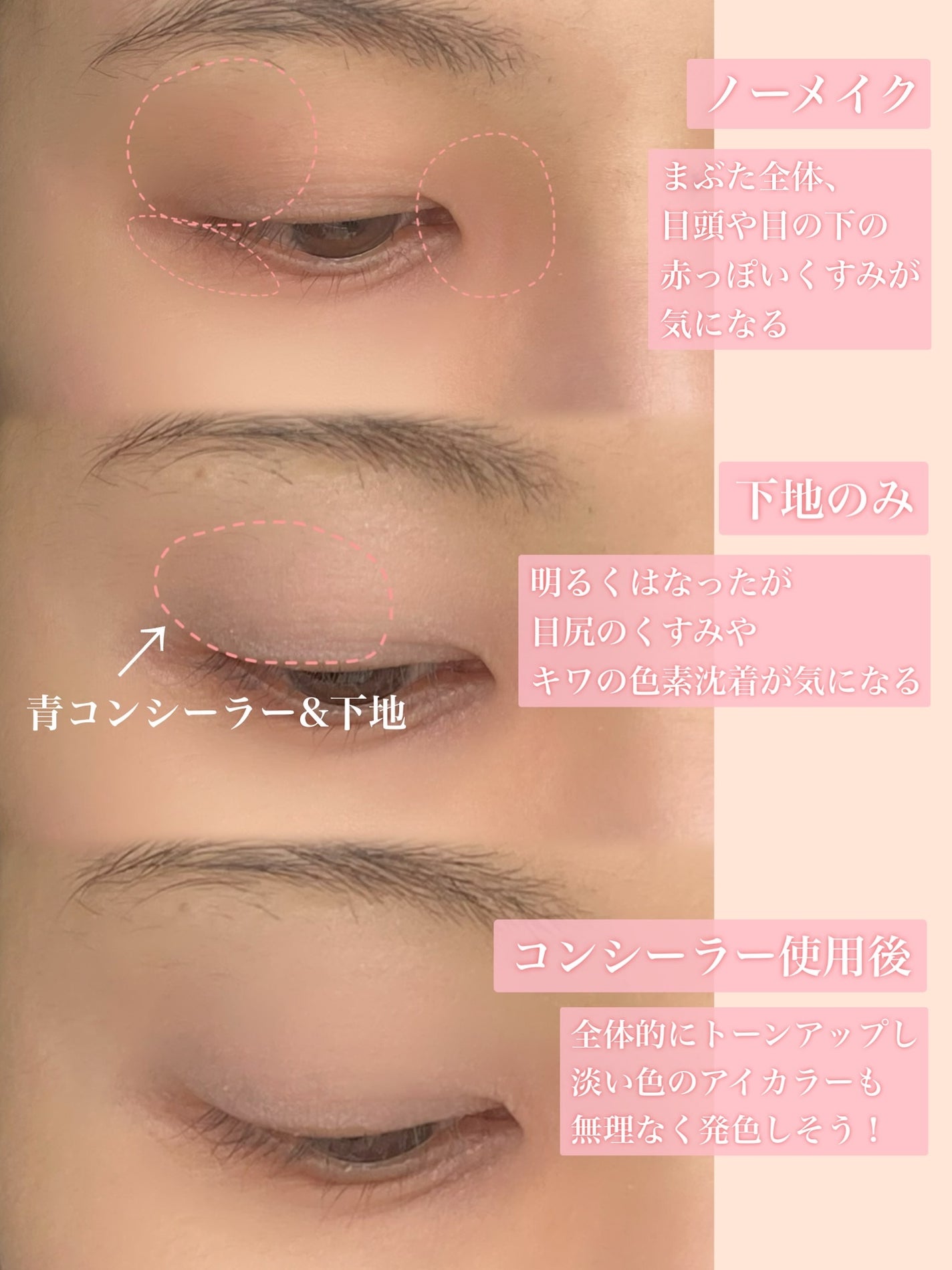 コンシールブレンダーパレット/LUNA/パレットコンシーラーを使ったクチコミ(4枚目)