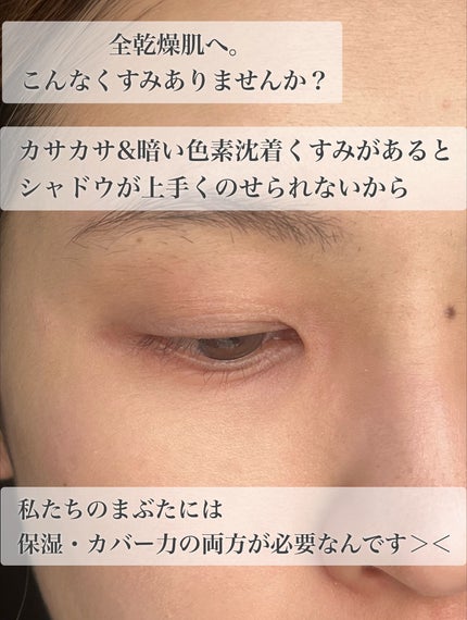 コンシールブレンダーパレット/LUNA/パレットコンシーラーを使ったクチコミ(2枚目)