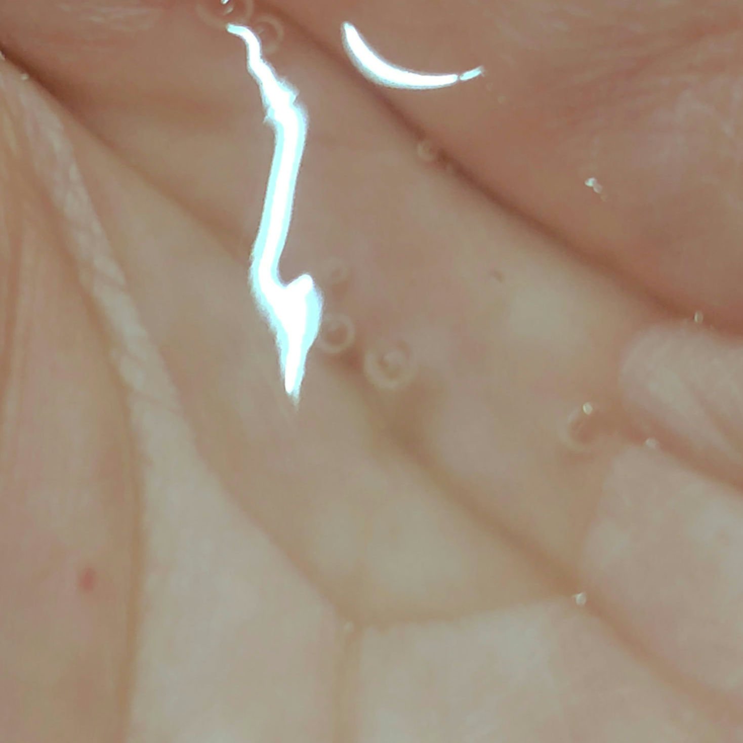 リポピールセラム/LIPOPEEL/美容液を使ったクチコミ（3枚目）