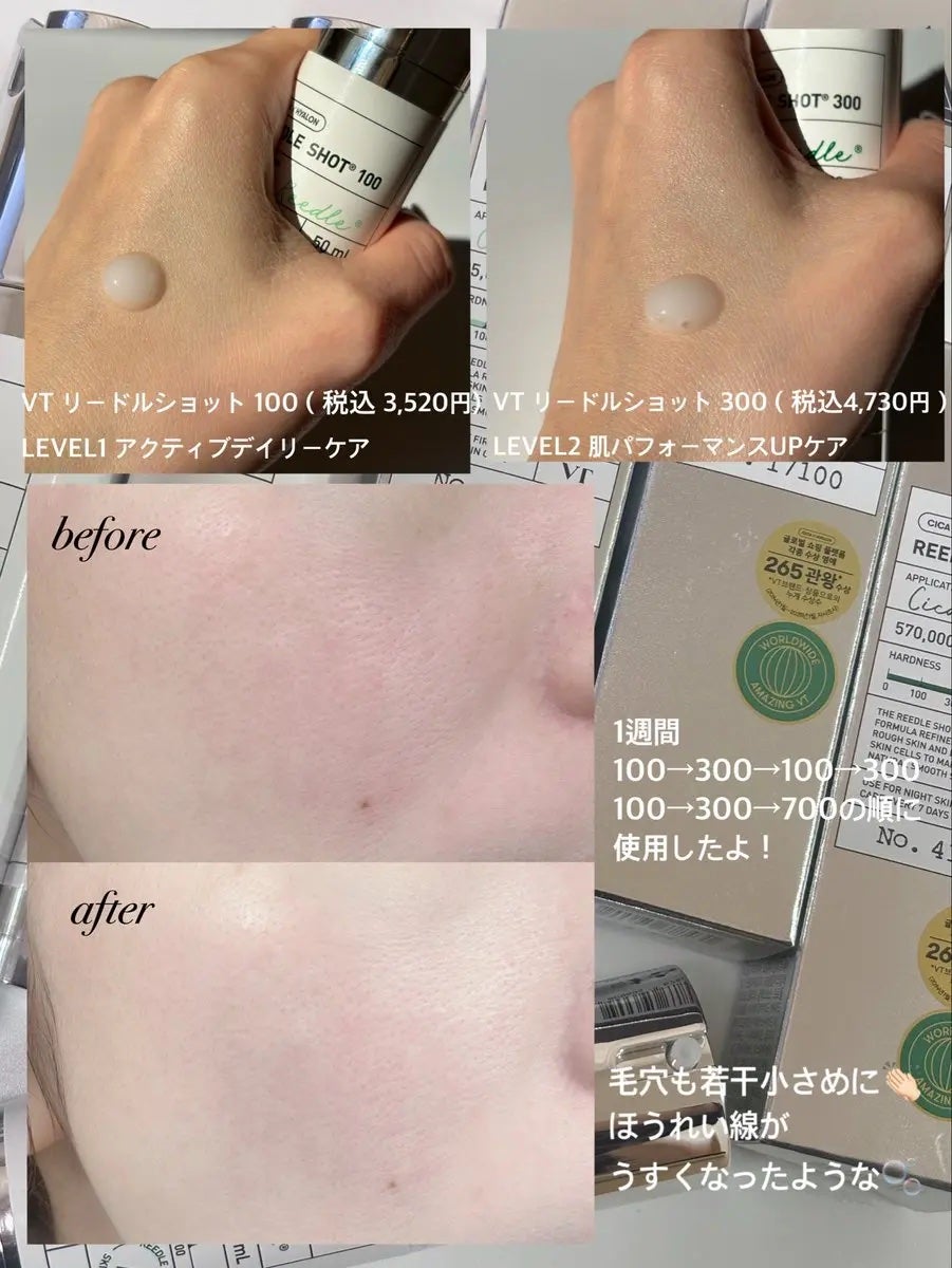 リードルショット100/VT/美容液を使ったクチコミ(4枚目)
