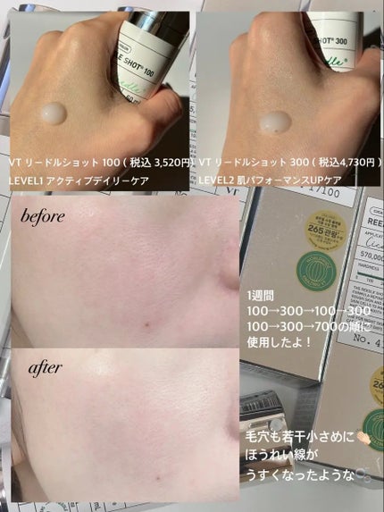 リードルショット100/VT/美容液を使ったクチコミ(4枚目)
