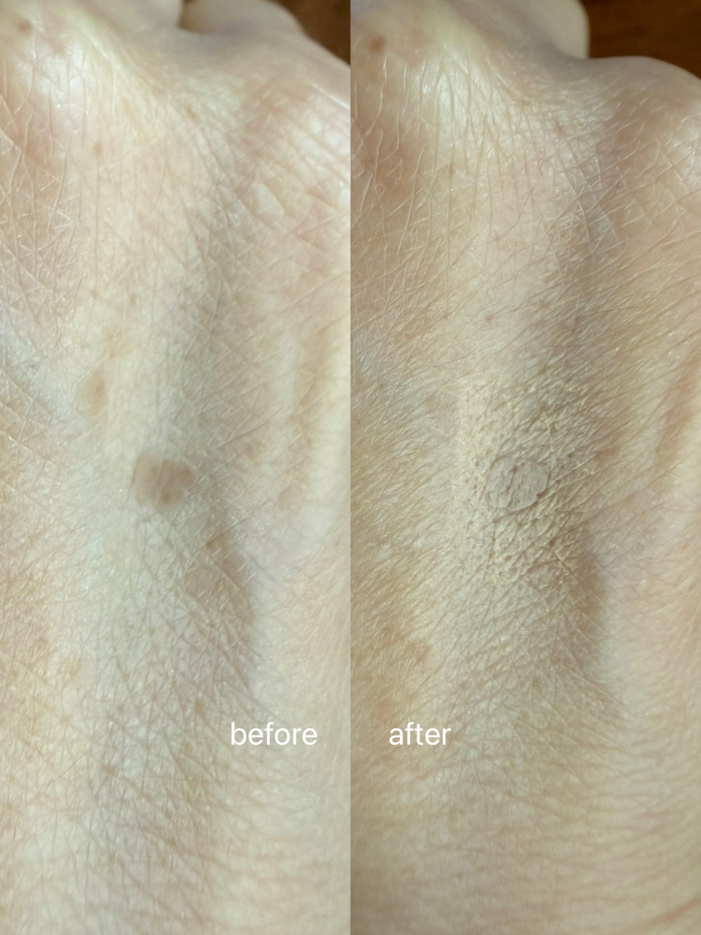 薬用UVコンシーラー/トランシーノ/スティックコンシーラーを使ったクチコミ(7枚目)