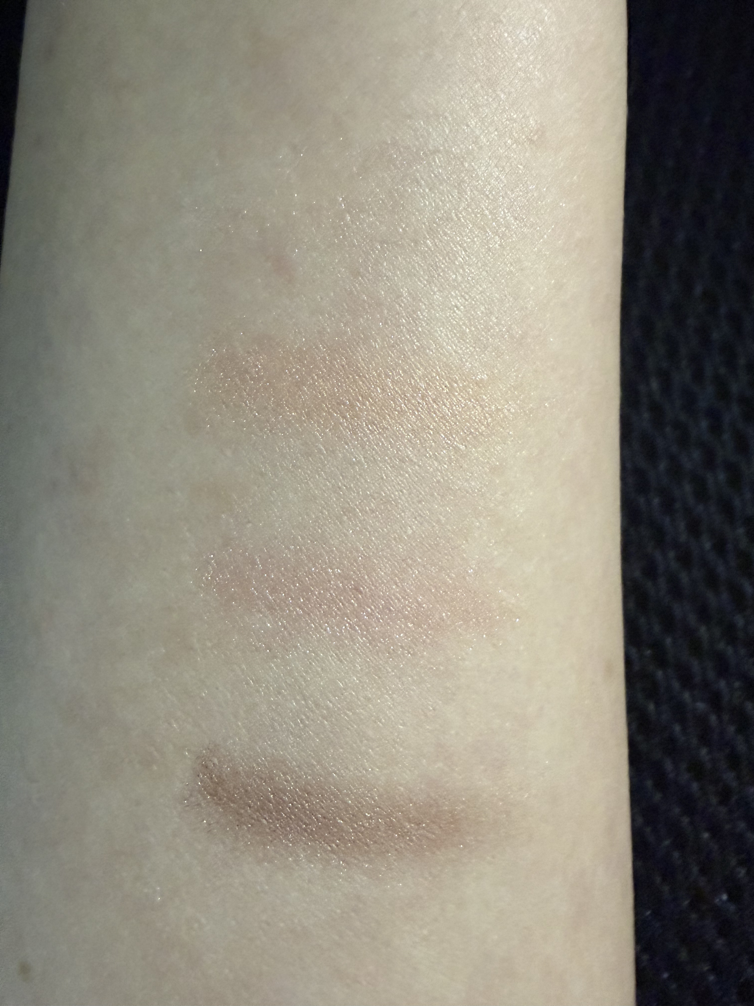 モイストバランス  ローション/ACSEINE/化粧水を使ったクチコミ（3枚目）