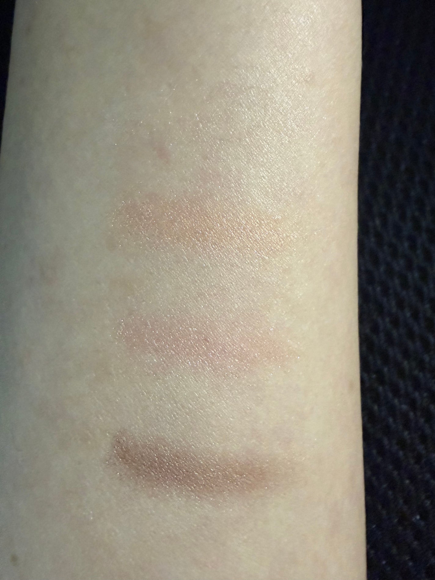 AD コントロールエッセンス/ACSEINE/美容液を使ったクチコミ(3枚目)