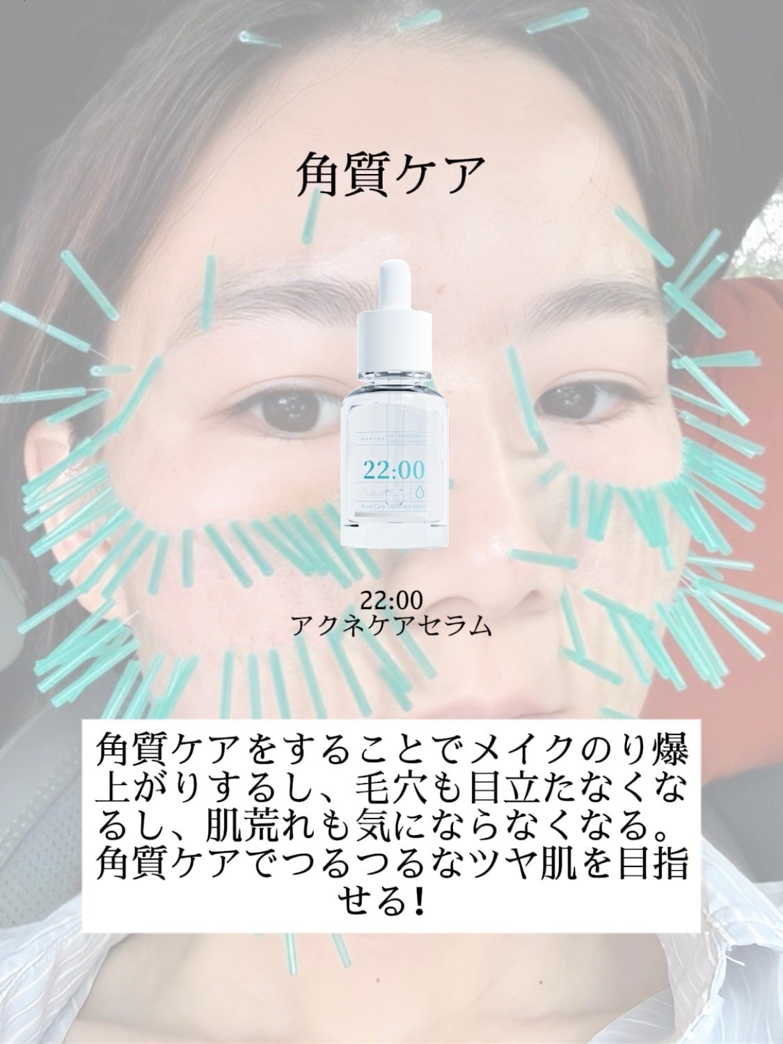 アネトス バランシング トリートメントクリーム/Anetos/フェイスクリームを使ったクチコミ(5枚目)