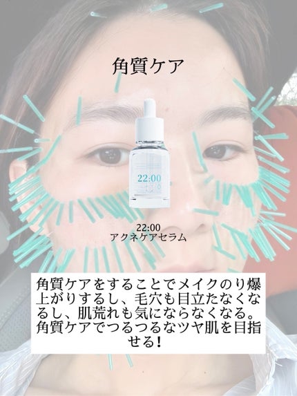 アネトス バランシング トリートメントクリーム/Anetos/フェイスクリームを使ったクチコミ(5枚目)