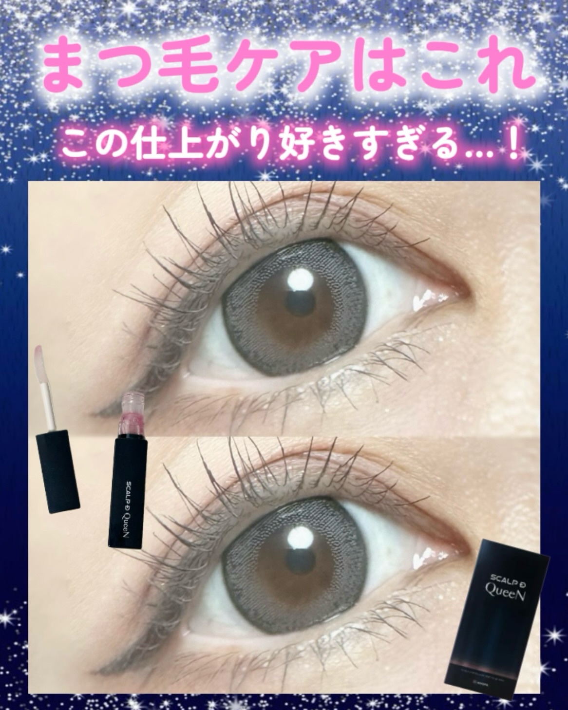 スカルプDまつ毛美容液　クイーン/アンファー(スカルプD)/まつげ美容液を使ったクチコミ（1枚目）
