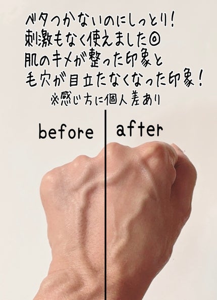 クリアニックホワイトトナー/Dr.Twenty Project/化粧水を使ったクチコミ(6枚目)