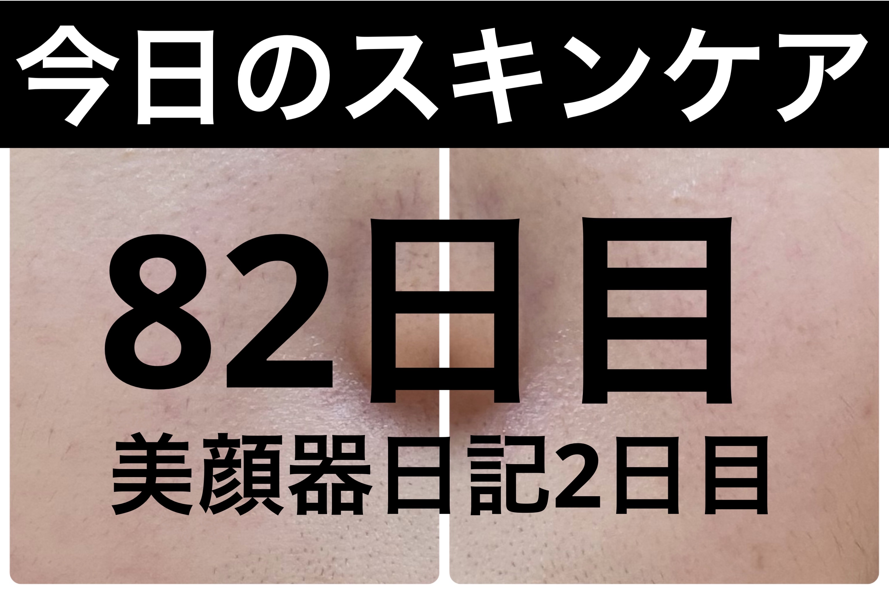 モーニングジェルウォッシュ/ビトレスキン/その他洗顔料を使ったクチコミ（1枚目）