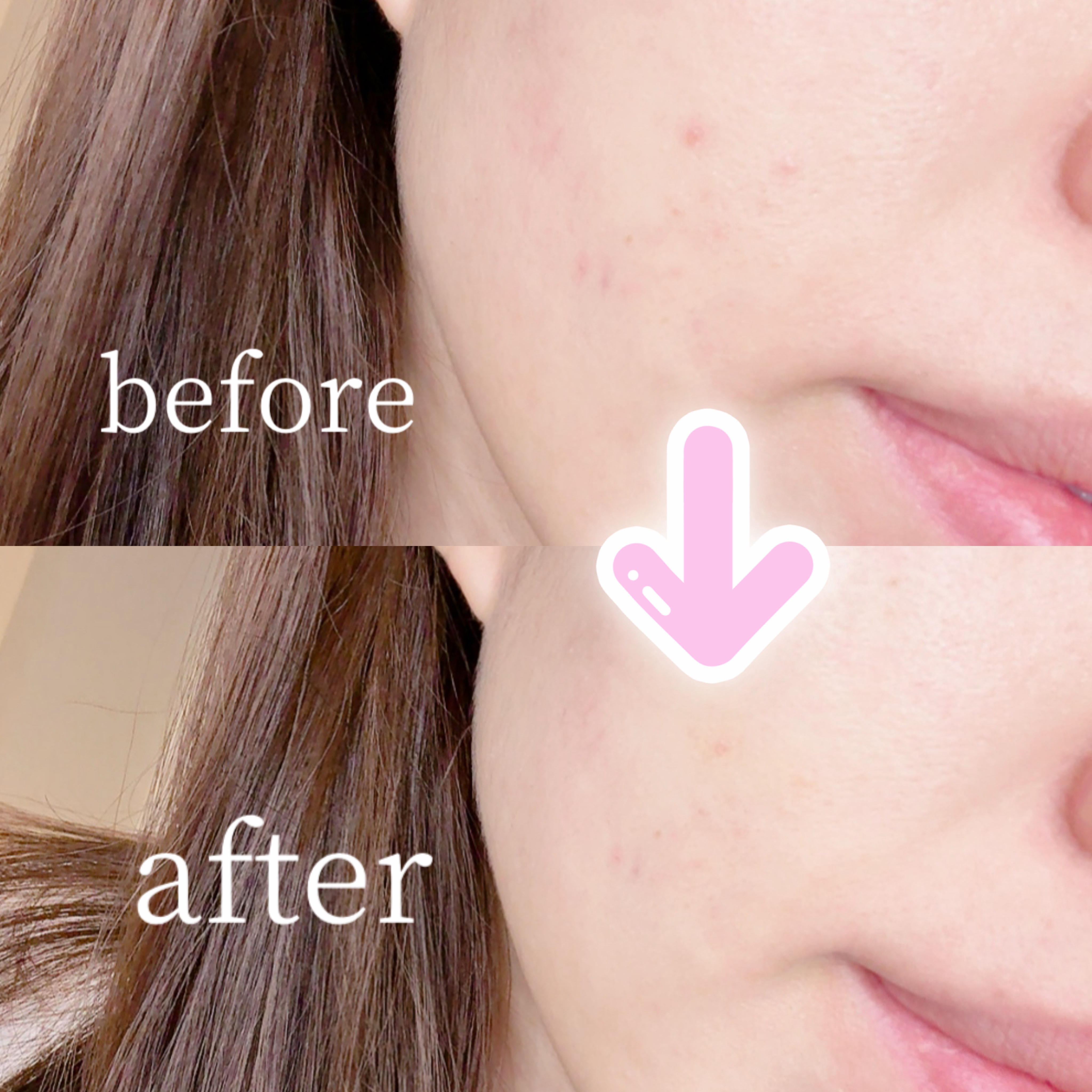 サイレントカバー コンシーラー/excel/パレットコンシーラーを使ったクチコミ（3枚目）