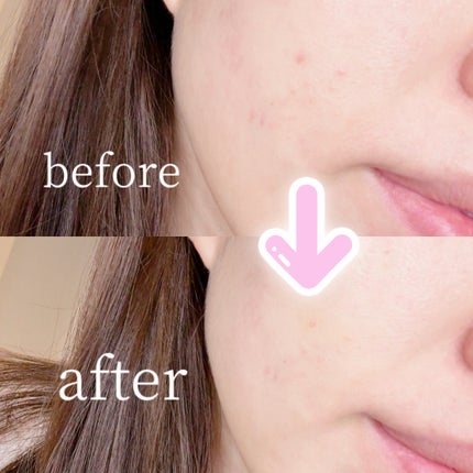 サイレントカバー コンシーラー/excel/パレットコンシーラーを使ったクチコミ(3枚目)