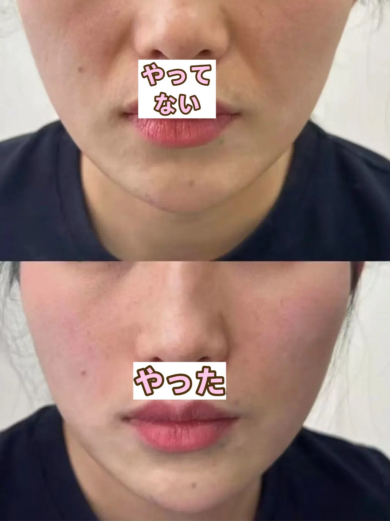 アネトス バランシング トリートメントクリーム/Anetos/フェイスクリームを使ったクチコミ（1枚目）