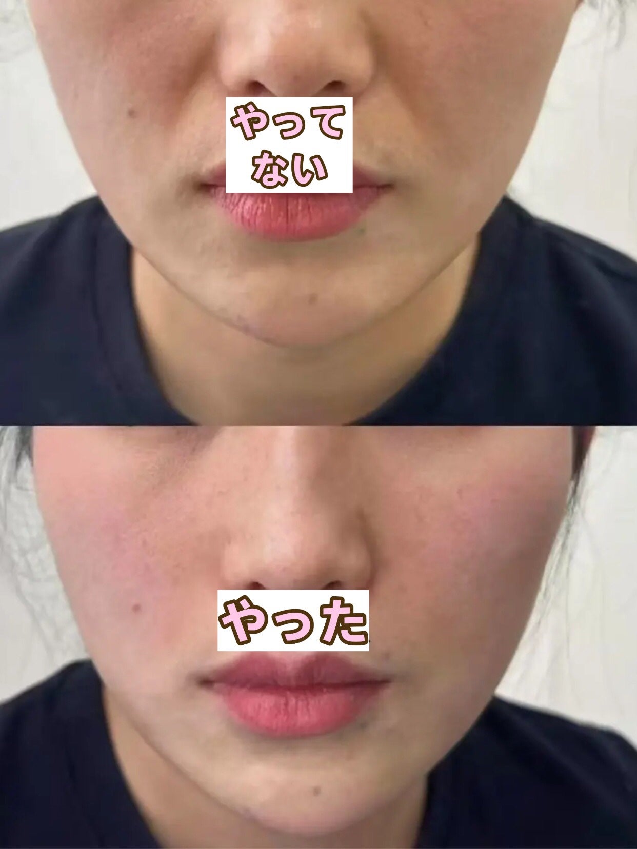 アネトス バランシング トリートメントクリーム/Anetos/フェイスクリームを使ったクチコミ(1枚目)