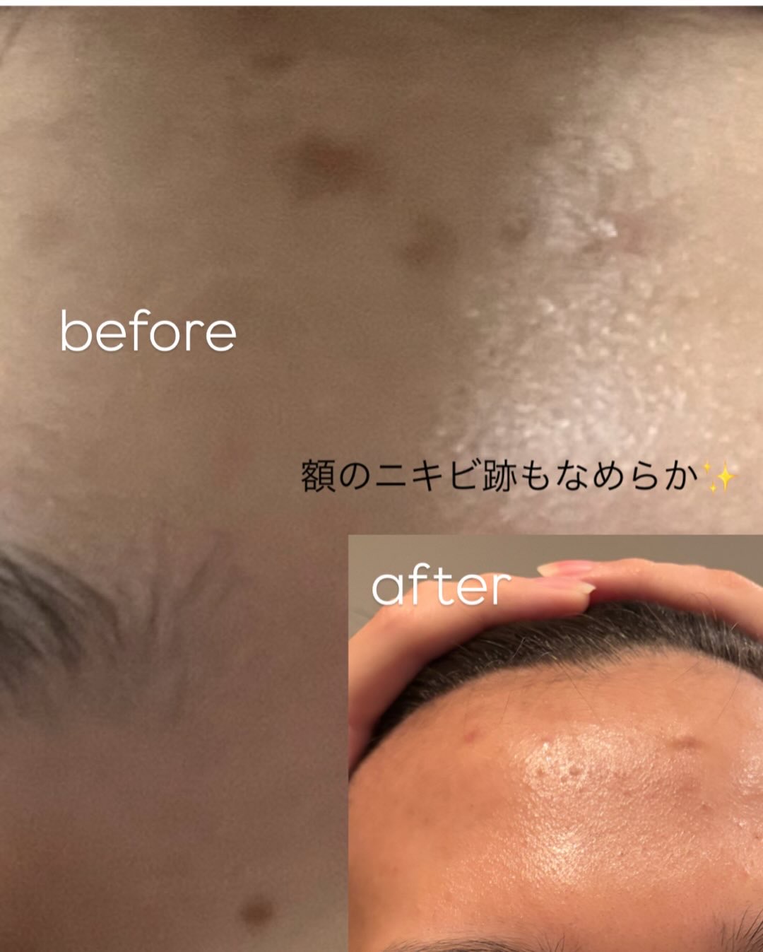 RXアドバンスド ザ・ビタミンC23セラム/COSRX/美容液を使ったクチコミ（3枚目）