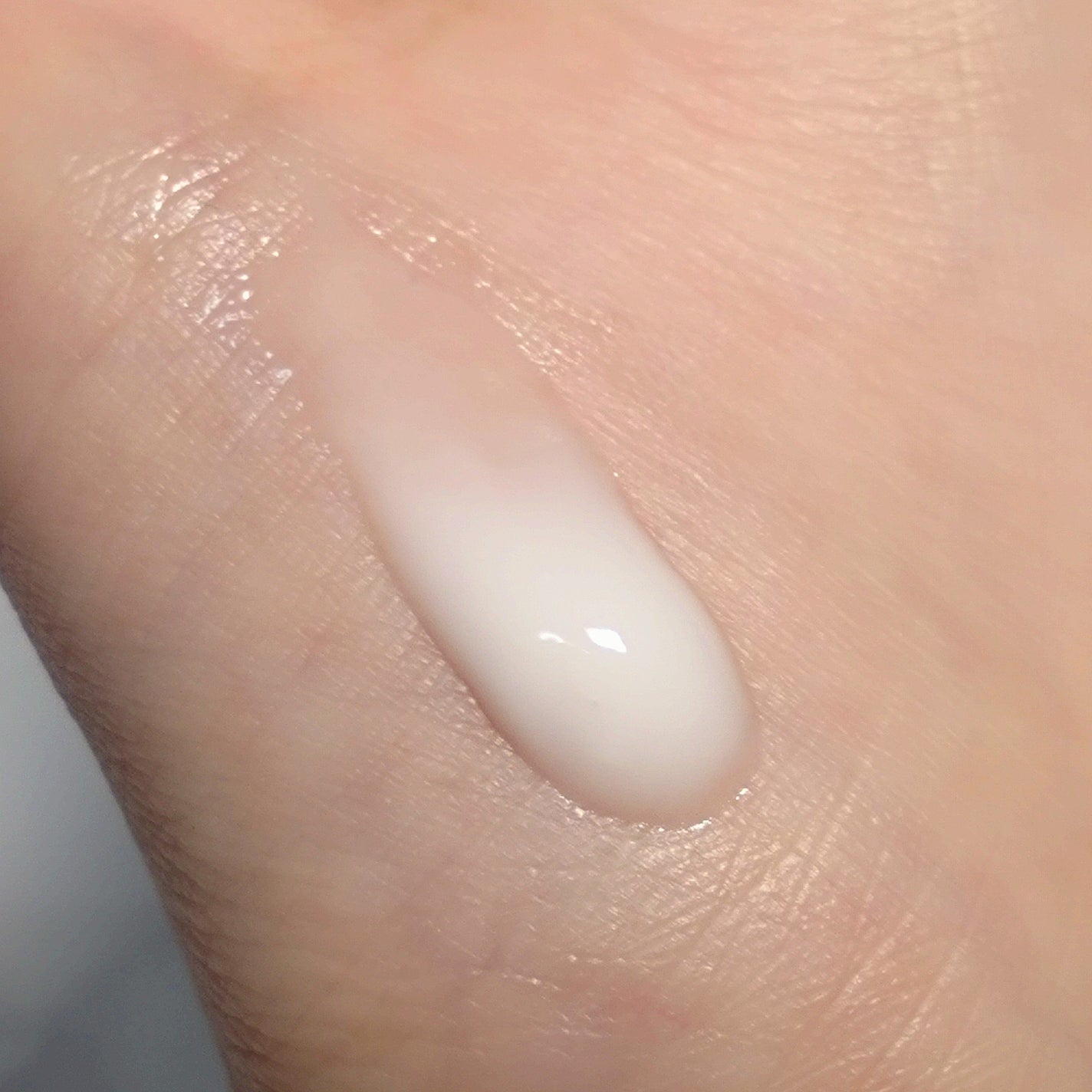 トリクセラ モイストスキンバリア クリーム/アベンヌ/ボディクリームを使ったクチコミ(3枚目)