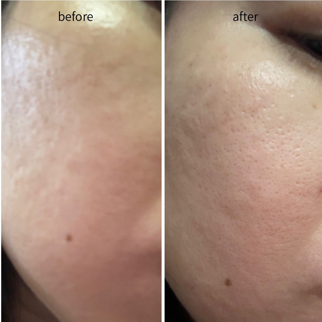 リードルショット100/VT/美容液を使ったクチコミ(4枚目)