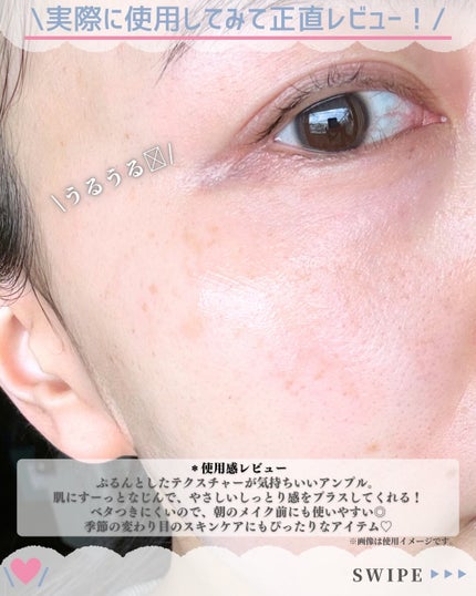 ReDRNエクソソームアンプル/Dr.nineteen/美容液を使ったクチコミ(4枚目)