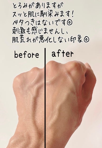 ナインセラム/Dr.Twenty Project/美容液を使ったクチコミ(4枚目)