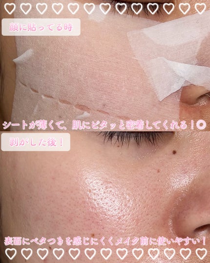 ウォンジョンヨ モイストアップレディスキンパック DM N 50枚入り/Wonjungyo/シートマスク・パックの画像