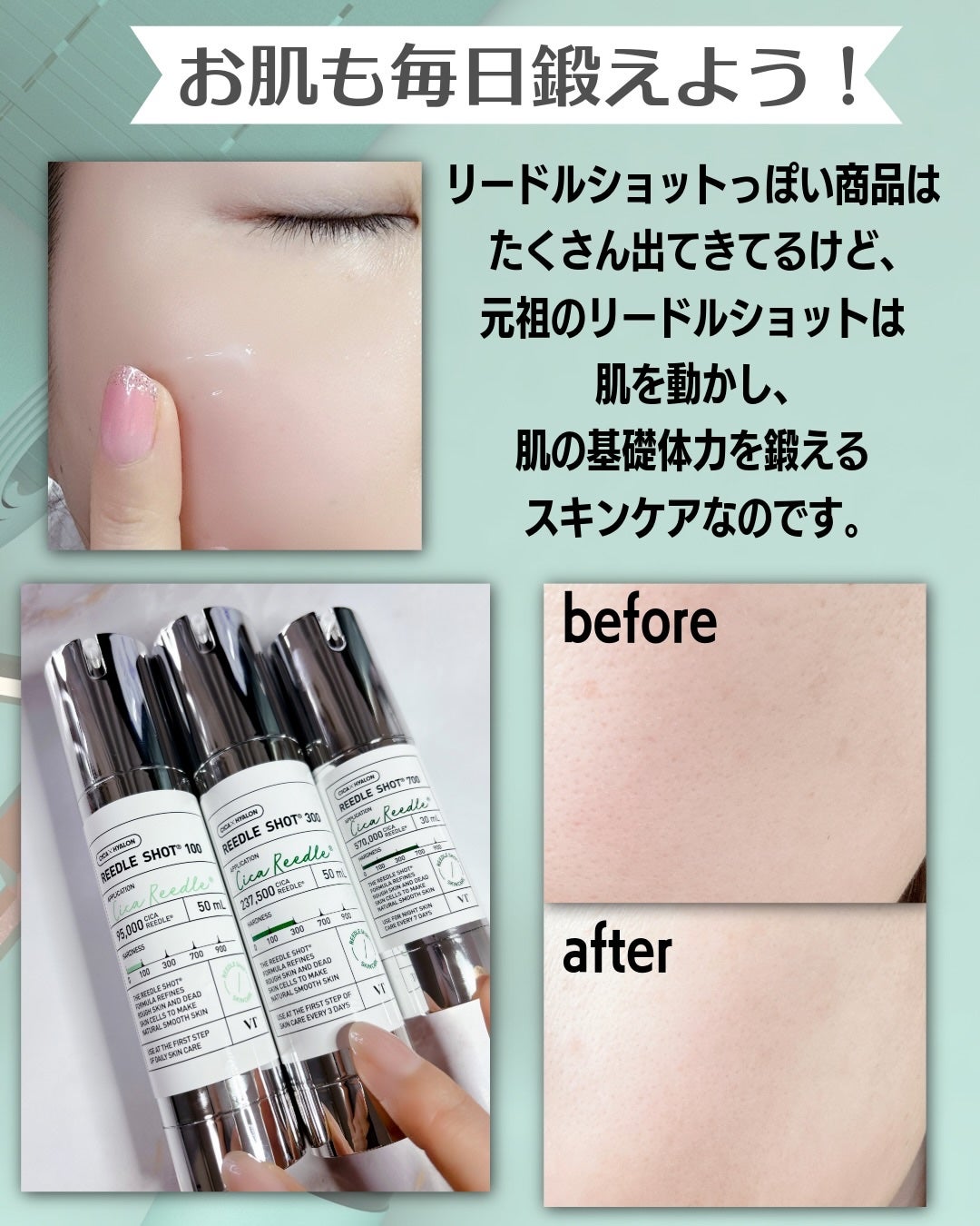リードルショット100/VT/美容液を使ったクチコミ(4枚目)