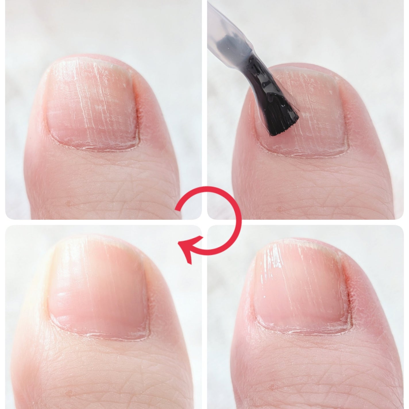 ベビーフット 足爪プロティンパック/ベビーフット/レッグ・フットケアを使ったクチコミ(4枚目)