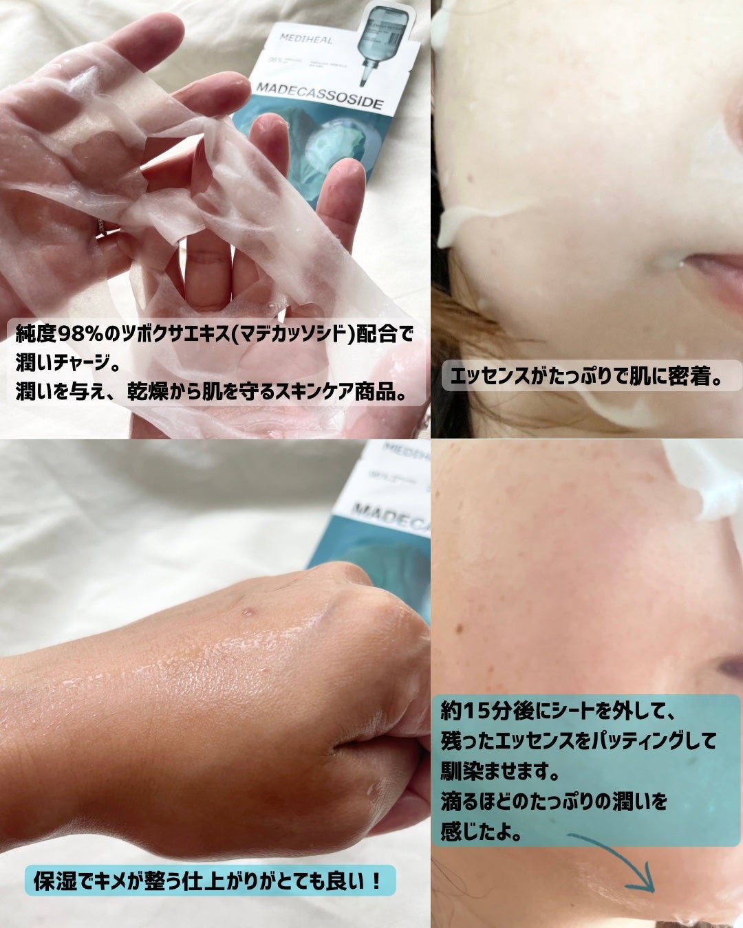 マデカッソシド エッセンシャルマスク/MEDIHEAL/シートマスク・パックを使ったクチコミ(2枚目)
