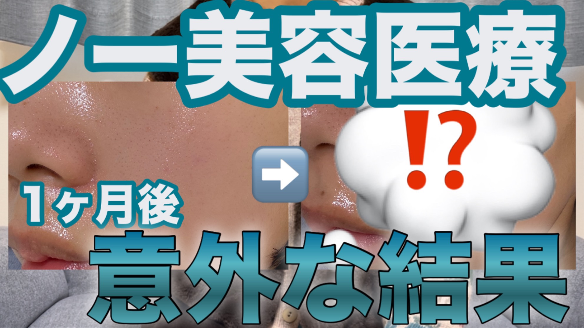 YouTube更新してます✩.*˚


#美容医療 #美容皮膚科 #スキンケア #ニキビ肌 #インナードライ