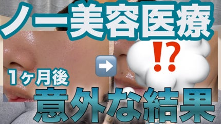 ãã¡ãð°ã¹ãã³ã±ã¢ããã on LIPS ãYouTubeæŽæ°ããŠãŸãâ©.*Ë#çŸå®¹å»ç#çŸå®¹ç®èç§#ã¹ã..ãïŒ1æç®ïŒ