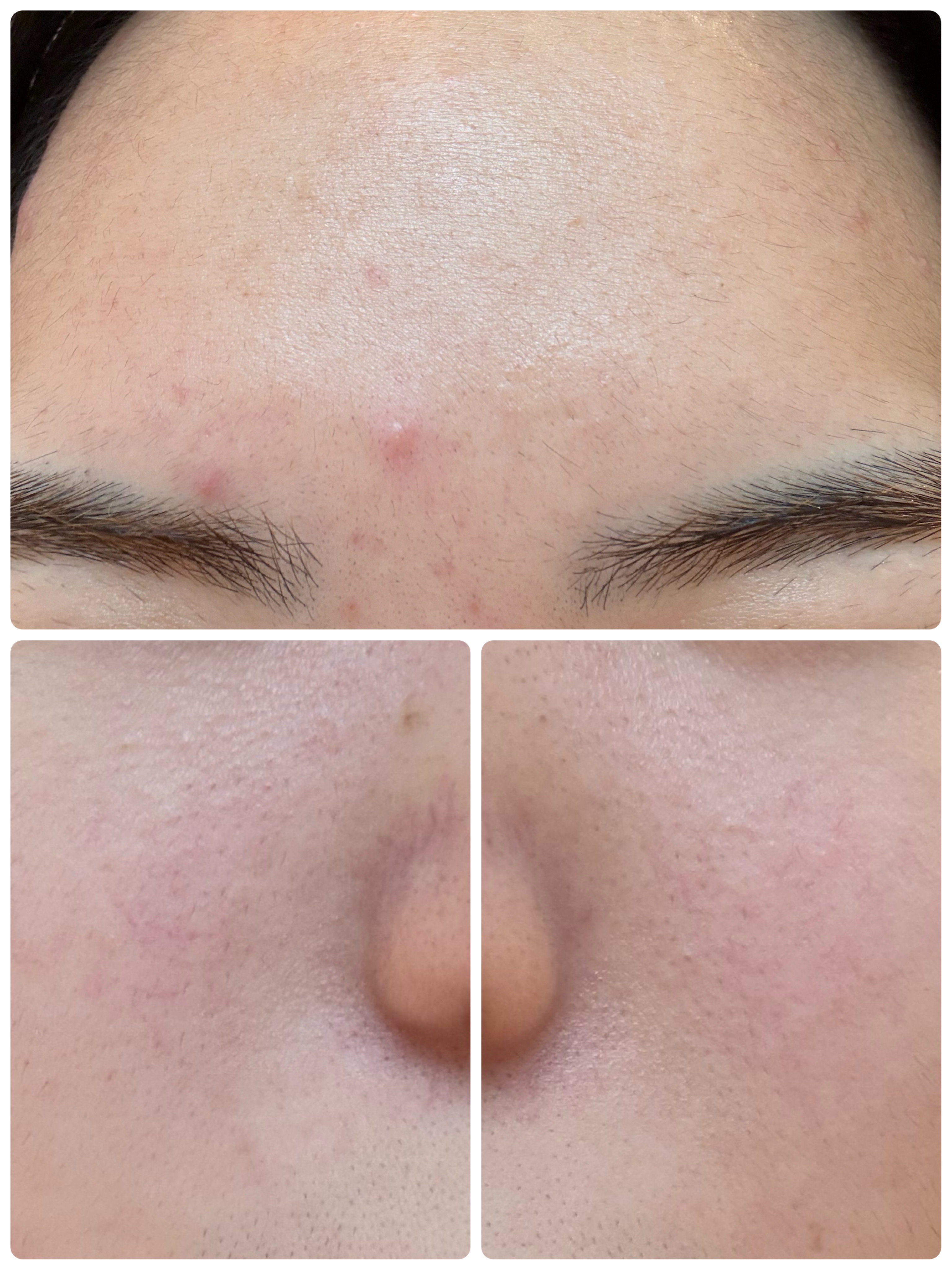 モーニングジェルウォッシュ/ビトレスキン/その他洗顔料を使ったクチコミ（3枚目）